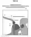 Fig. 15 - MEDICAL GUIDING SYSTEM