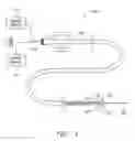 Fig. 02 - Detachable aneurysm neck bridge