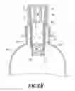 Fig. 10 - Ingenious Lid Structure for Infusion Drinks Percolator