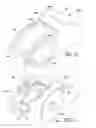 Fig. 06 - Two-step roller finger cam follower