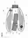 Fig. 09 - Surgical fastening device with cutter