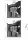 Fig. 07 - THREE-LOOP TEMPORAL INTERPOLATION FOR ERROR CONCEALMENT OF MULTIPLE DESCRIPTION CODING