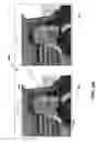 Fig. 08 - THREE-LOOP TEMPORAL INTERPOLATION FOR ERROR CONCEALMENT OF MULTIPLE DESCRIPTION CODING