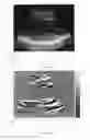 Fig. 167 - Systems and method for composite elastography and wave imaging