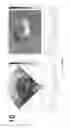 Fig. 197 - Systems and method for composite elastography and wave imaging