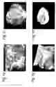 Fig. 02 - Method for medical imaging of body cavities