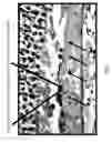Fig. 02 - Treatment for eye disorder