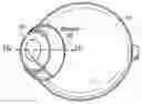 Fig. 01 - Method of treating a disease in an eye using a scleral lens