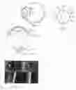 Fig. 02 - Method of treating a disease in an eye using a scleral lens