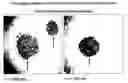 Fig. 01 - Delivery of micro- and nanoparticles with blood platelets