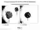 Fig. 02 - Delivery of micro- and nanoparticles with blood platelets