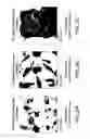 Fig. 03 - Delivery of micro- and nanoparticles with blood platelets