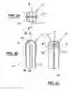 Fig. 03 - Custom-fit implant surgery guide and associated milling cutter, method for their production, and their use