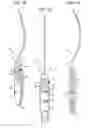 Fig. 02 - NEEDLE INSTRUMENTS AND IMPLANTABLE SLING ASSEMBLY; KITS COMPRISING THESE COMPONENTS; AND METHODS FOR USE