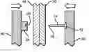 Fig. 01 - Tissue holding implants