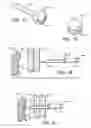 Fig. 06 - Tissue holding implants