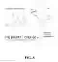 Fig. 09 - GARMENT FOR USE IN A BREAST SELF-EXAMINATION