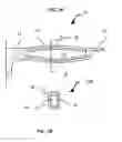 Fig. 02 - Cookware handle
