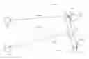 Fig. 01 - Binocular indirect ophthalmoscope fixation light