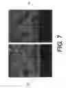 Fig. 06 - Prevention and control of intermetallic alloy inclusions