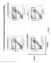 Fig. 04 - Method of treating autoimmune diseases