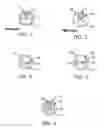 Fig. 02 - Small diameter dual lumen catheter