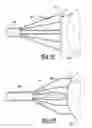 Fig. 06 - Electrical cautery device