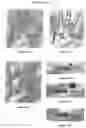 Fig. 06 - Intramedullary fixation device for fractures