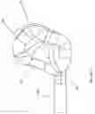 Fig. 14 - ARTICULATING CAVITATION DEVICE