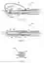 Fig. 17 - ARTICULATING CAVITATION DEVICE