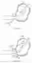 Fig. 21 - ARTICULATING CAVITATION DEVICE