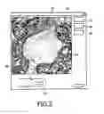 Fig. 05 - Interactive computer-aided diagnosis