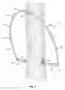 Fig. 04 - Portable tree mounted hunting blind