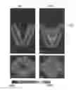Fig. 01 - Method and Device for Handling Sedimenting Particles