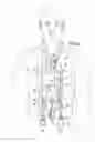 Fig. 02 - IV infusion bag carrier pack
