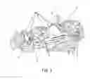 Fig. 02 - RETENTION DEVICE