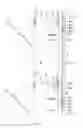 Fig. 05 - Bracket structure for external wall and external wall construction structure