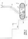 Fig. 02 - Stair assist robot mechanism and method
