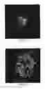 Fig. 02 - Methods And Compositions For The Treatment Of Ocular Neovascularization