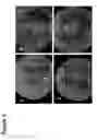 Fig. 02 - Microalgae-derived compositions for improving the health and appearance of skin
