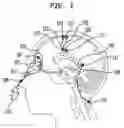 Fig. 02 - DEVICES, METHODS, AND SYSTEMS FOR ACCESSING NATIVE NEURONS THROUGH ARTIFICIAL NEURAL MEDIATORS (ANMS)