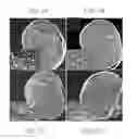 Fig. 02 - Material and Methods for Nerve Grafting