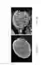 Fig. 07 - Material and Methods for Nerve Grafting