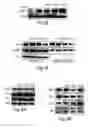 Fig. 09 - IDENTIFICATION OF OXIDATIVELY MODIFIED PEPTIDE SEQUENCES IN THE PROTEOME (LOSCALZO)