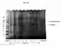 Fig. 04 - CHROMATOGRAPHIC METHODS FOR ASSESSING ADENOVIRUS PURITY