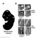 Fig. 01 - HUMAN MAP2 GENE PROMOTER