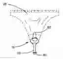 Fig. 01 - Incontinence device