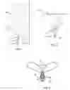Fig. 02 - Incontinence device