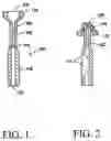 Fig. 02 - Everting gynecological brachytherapy applicator