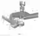 Fig. 45 - Deflection rod system for a spine implant including an inner rod and an outer shell and method